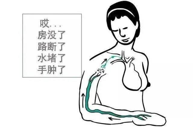 由于手术和放射治疗的影响,造成淋巴管缺失或阻塞,淋巴液回流受阻